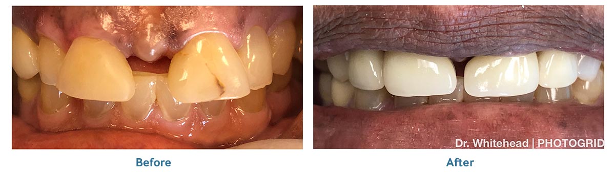 Smile Gallery Altamonte Springs Florida Palm Springs Dental