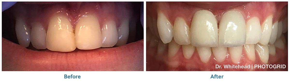 Smile Gallery Altamonte Springs Florida Palm Springs Dental